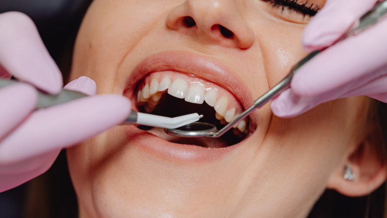 Hyde Park Dental Care Provides Comprehensive, Patient-Focused Dental Services in Sydney CBD